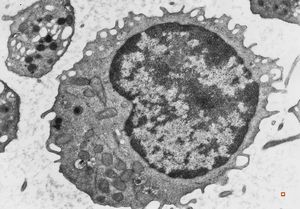 F,50y. | blood … lymphocyte and thrombocyte F,50y. | blood … lymphocyte and thrombocyte